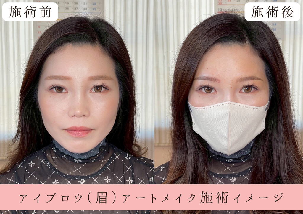 さがわ皮膚科の医療アートメイク